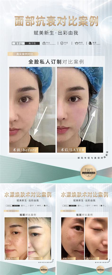 对比图：左侧为低码率模糊画面，右侧为高码率清晰画面